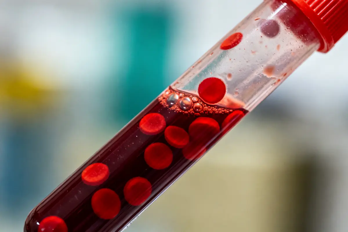Tube à essai avec des échantillons sanguins pour analyser l'hematocrite contenu