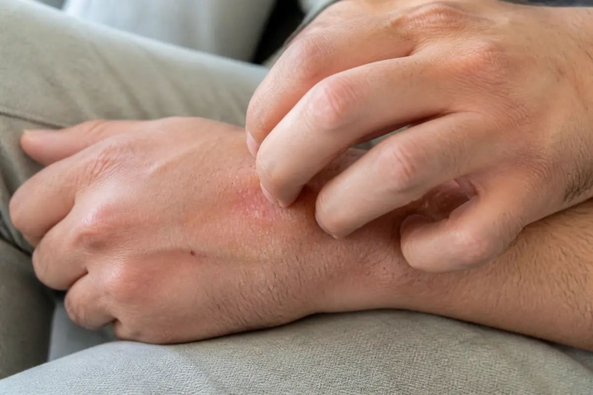 Main droite qui gratte : causes, significations et que faire ?